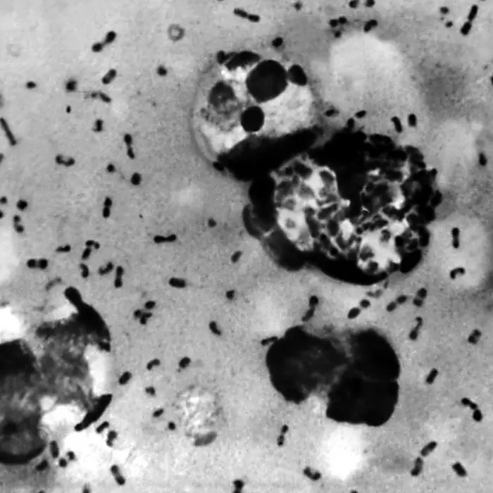 Image of the black plague under a microscope